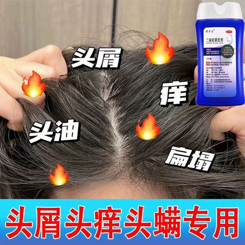 头皮屑治疗 去屑药头皮痒脂溢性皮炎 洗发水专用药毛囊炎头部专用药二