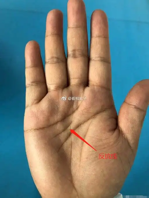 你的手相出现了一条特殊的纹路——反抗线,你为人富有正义感,不肯服输