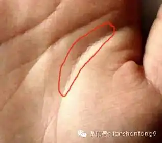 警惕手相里有这样的岛纹说明身体已有疾病