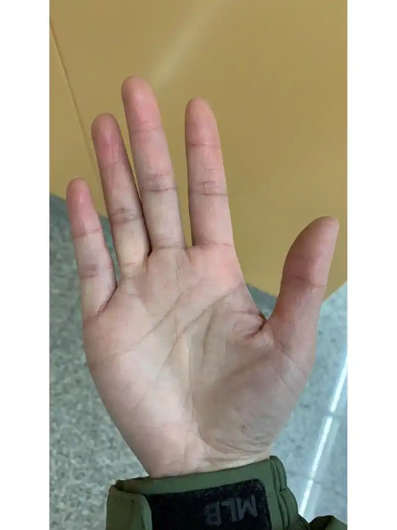 求助,最近身体上出了状况,有人会看么,真的我的生命线就这么短么?