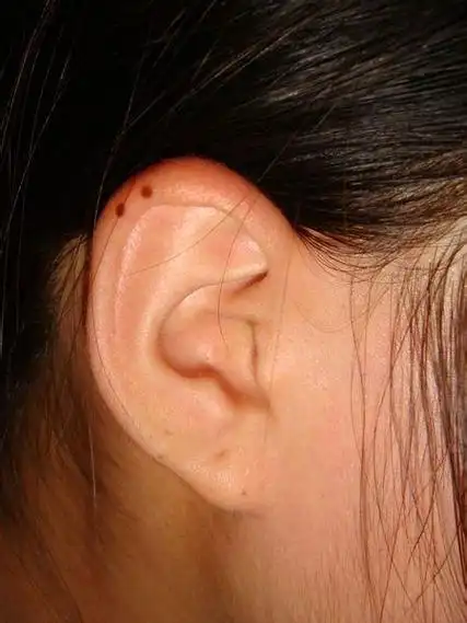 不利于女人婚姻的四颗痣,感情不顺