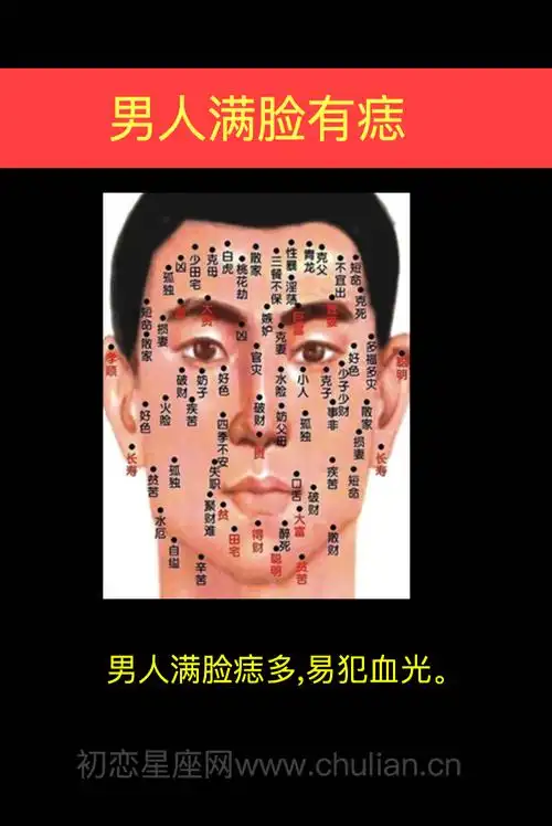 颧骨偏上方有痣(颧骨上有痣的人命运如何)