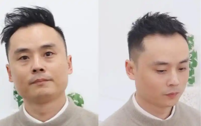 男生m型发际线适合的短发