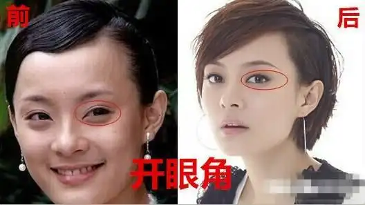 孙俪自曝曾是丑女 更坦言"整过容"