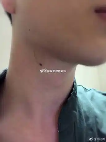 男人脖子右边长痣好不好?代表家庭观念薄弱,不太顾家.