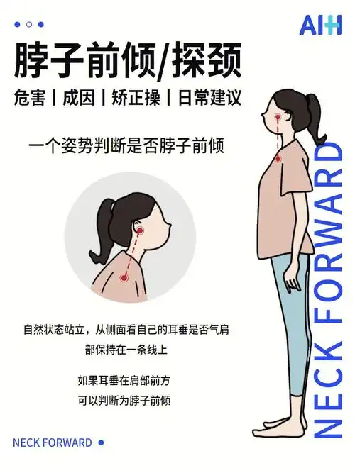 如何矫正脖子前倾内附日常建议