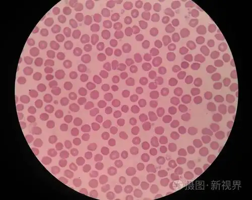 血红细胞医学背景