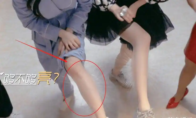 都说宋轶的颜值高可谁注意她的腿跟戚薇同框两人腿型很不一样