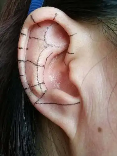 《蓝海2020首期耳诊耳疗线上公开课》2月26日就要开课了!