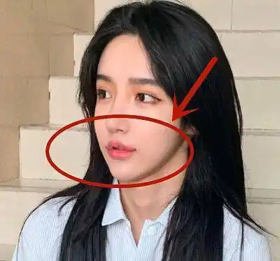 艾比为避免和潘南奎撞脸,毅然做"嘟嘟唇"手术,最终效果却令人失望