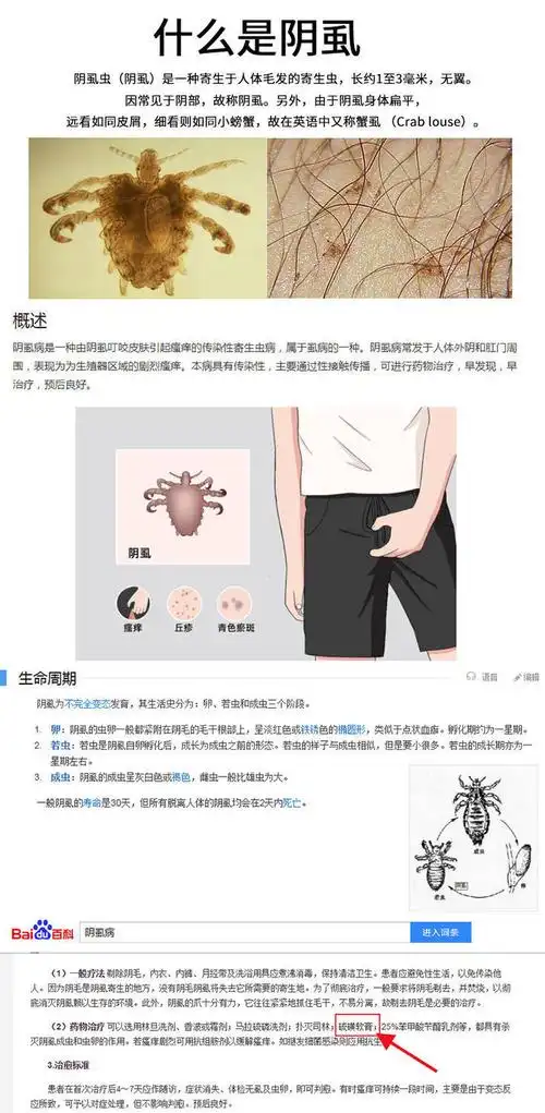 草本硫磺软膏10%除螨疥阴虱疮虫卵结节私处止瘙痒外用乳膏 5%硫磺含量