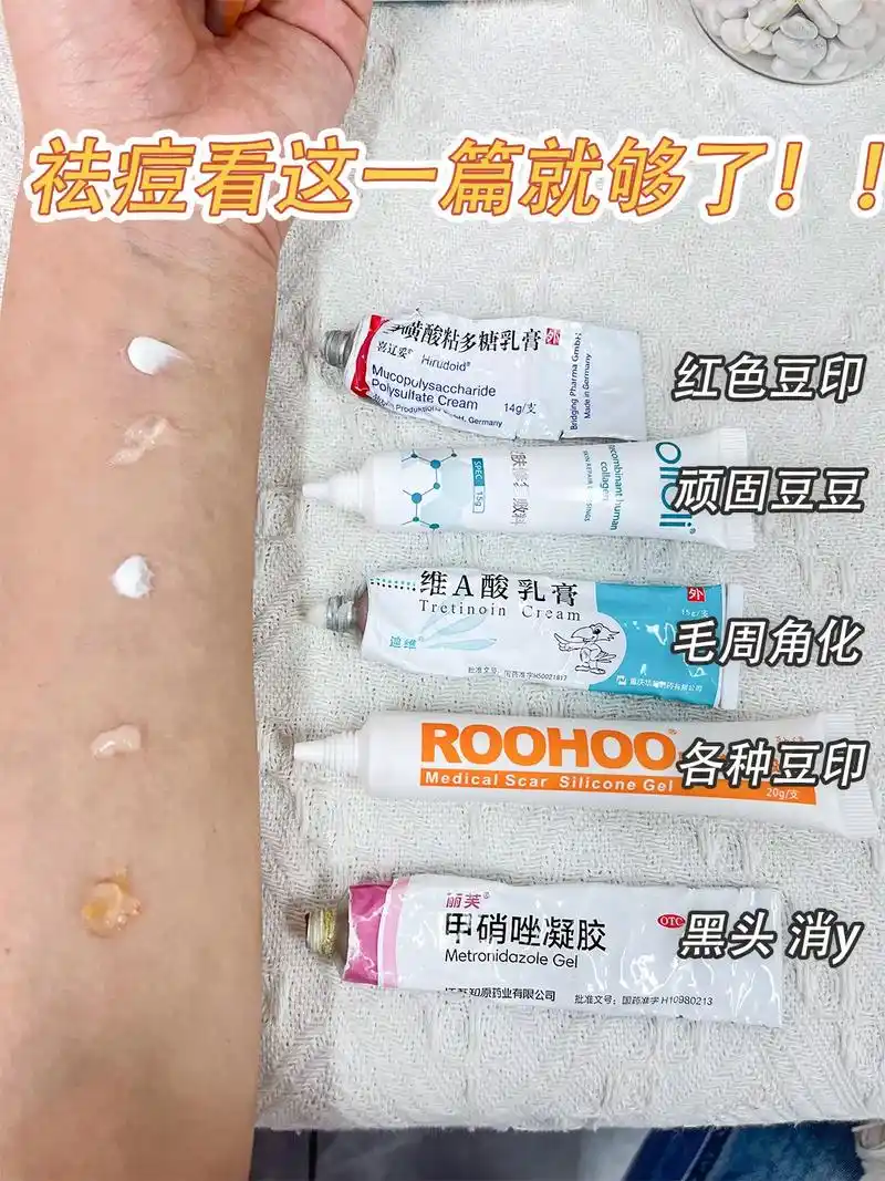 祛痘膏看介个就够了.#痘痘#痘印 大妮脸上总是张豆豆一直也不 - 抖音