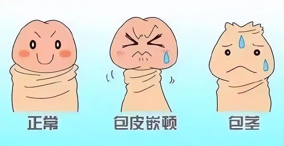 2016年大二学生切包皮13天后竟死亡调查后发现医院黑幕