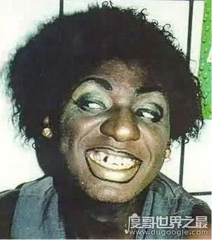 吉尼斯纪录:世界上最丑的女人