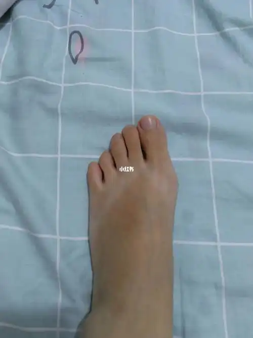 这是一只广东人的脚