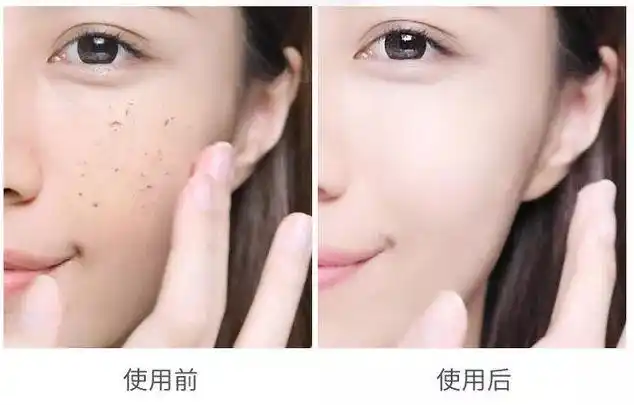 医美级去角质慕斯,7天闪电美白,嫩回18岁!