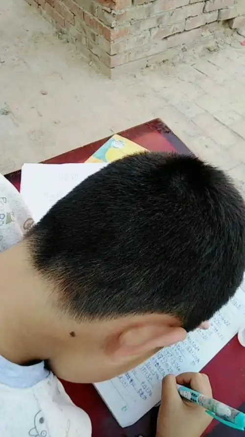 第一次见九岁的小孩子头上长了一根白头发这是什么原因:求解?