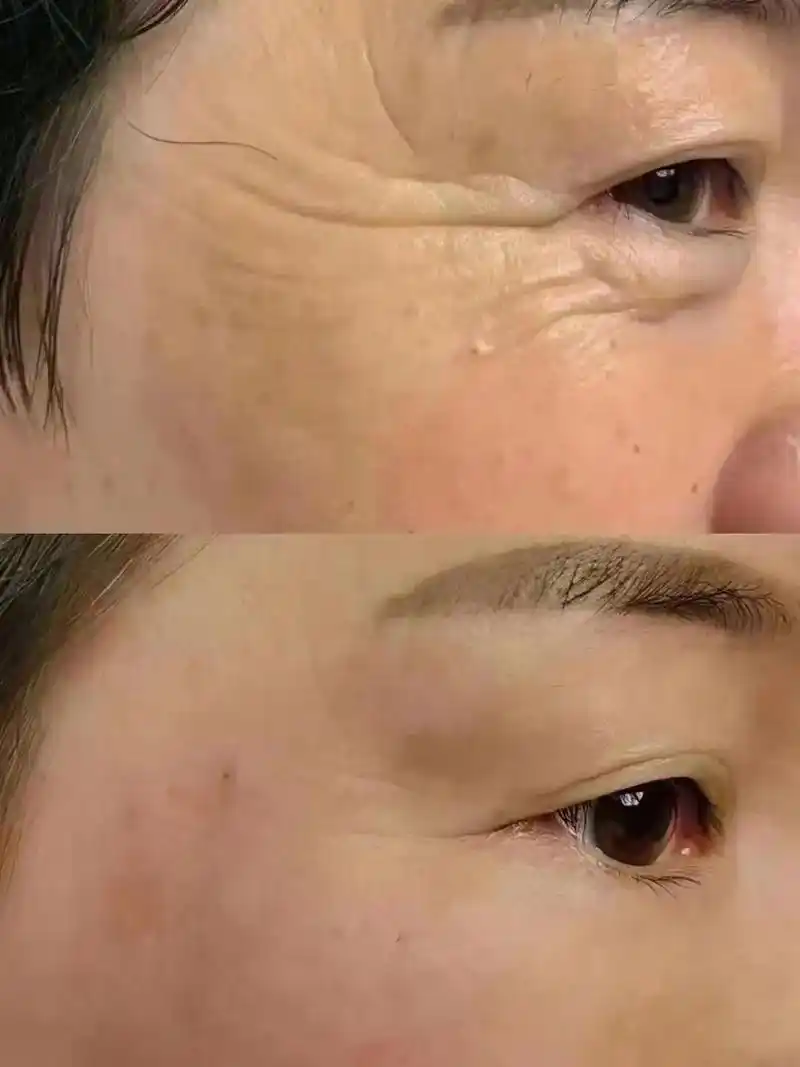 皮肤衰老的过程#精致女人必备  - 抖音