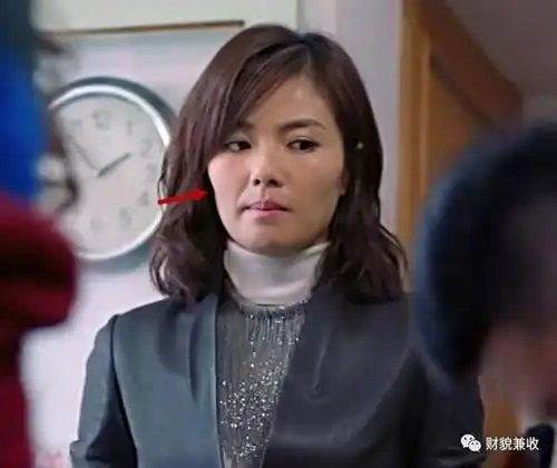 她属于女明星里,颧骨高 颧弓外扩比较严重的,年轻时有婴儿肥和胶原