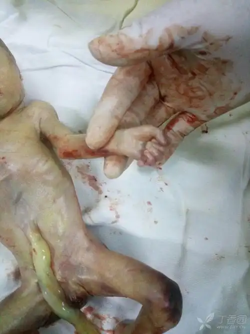 780_1040竖版 竖屏