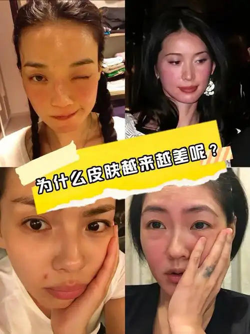 让你皮肤变差的566大原因75一定有你做错的
