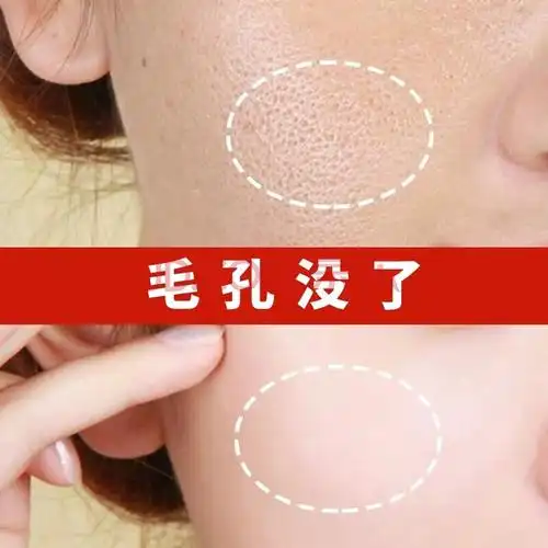 【精选好货】收缩毛孔修护精华液脸部眼部收缩毛孔收毛孔粗大修复男女