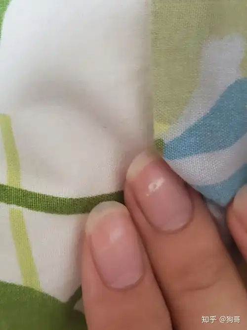 急我手指甲里的到底是什么