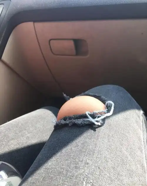 今天穿了一件很久没穿的裤子这坨凸出来的肉有一丝尴尬