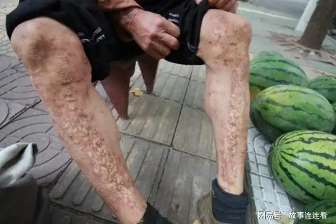 男子一生杀蛇无数后患严重皮肤病真武帝化身道士前来解救