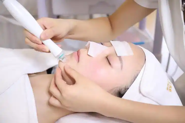 鼻子反复长黑头用这3种去黑头方法