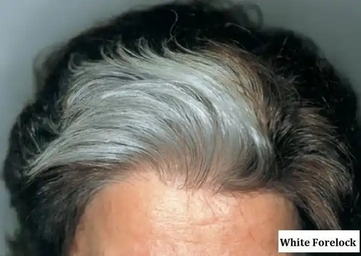 深圳一副区长前额的一簇白发引关注,"挑染"还是天生?