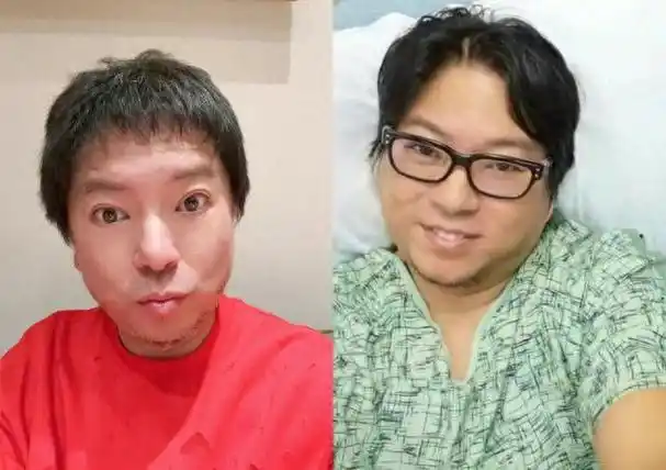 53岁高晓松晒近照暴瘦,网友直呼认不出,疑过度医美撞脸华晨宇|高晓松