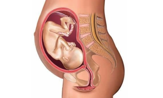 有子宫腺肌症生孩子是剖腹产还是顺产