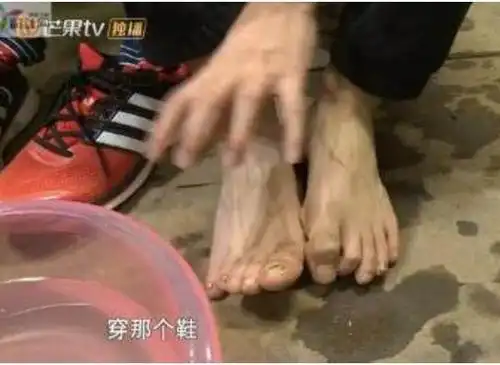 白敬亭的脚终于露出庐山真面目,但是脚趾头歪的看着有点心疼