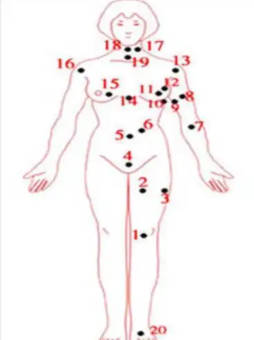 痣相图解分析:女人全身痣相图解大全(图)