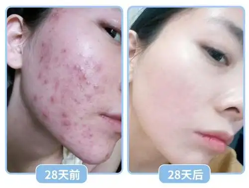 20岁出道被喷丑,9年换头5次,34岁撩遍娱乐圈,她是怎么做到的!