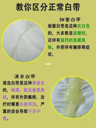 正常白带与异常图片