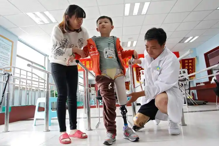 追贼致残的小伙回报社会,一年投20万帮残障人士免费装假肢