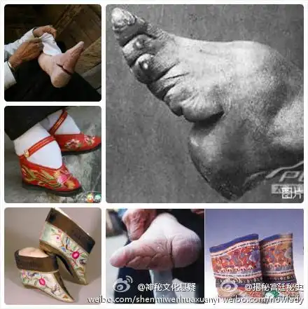 女孩在五六岁开始缠足,方法是用长布条将拇趾以外的四个脚趾连同