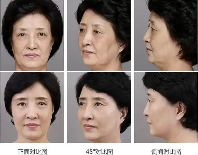 随着年龄的增长,皮肤状况开始变得干燥,缺水和暗沉没有光泽.