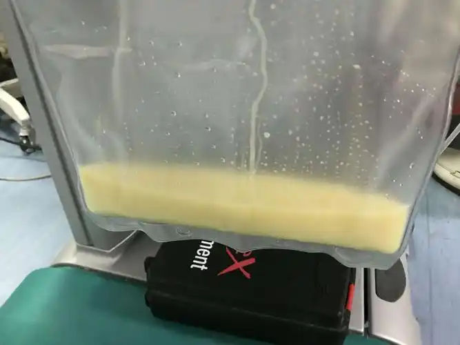 置换出的是乳糜样的血浆