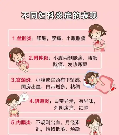 你知道自己妇科炎症表现出来是什么症状吗