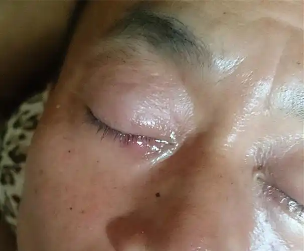 2013-08-14 石求兵 医师 下眼皮起个包是不是上火怎么办 2014-02-04