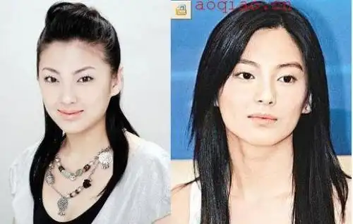 李小璐柳岩杨乐乐谢娜 当红女星最新整容前后对比照(组图)