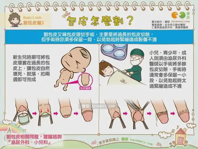 包茎|手术_网易订阅