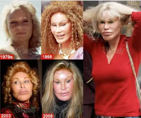 jocelyn wildenstein
