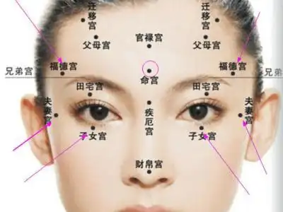 易出轨女人面相痣图解女人痣长在哪里容易出轨