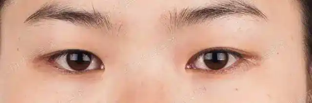 我的眼睛其实也算是双眼皮,只不过是内双.▼