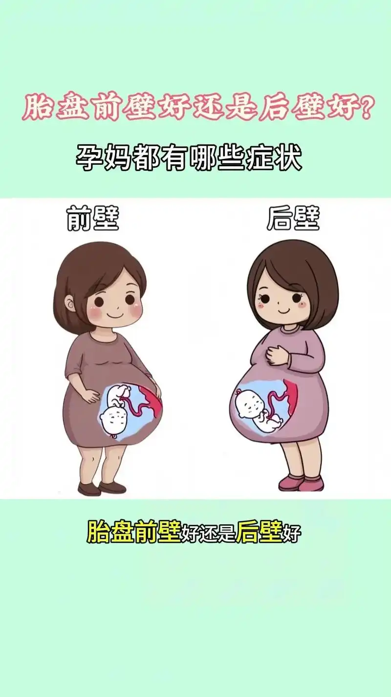 92胎盘前壁好还是后壁好?