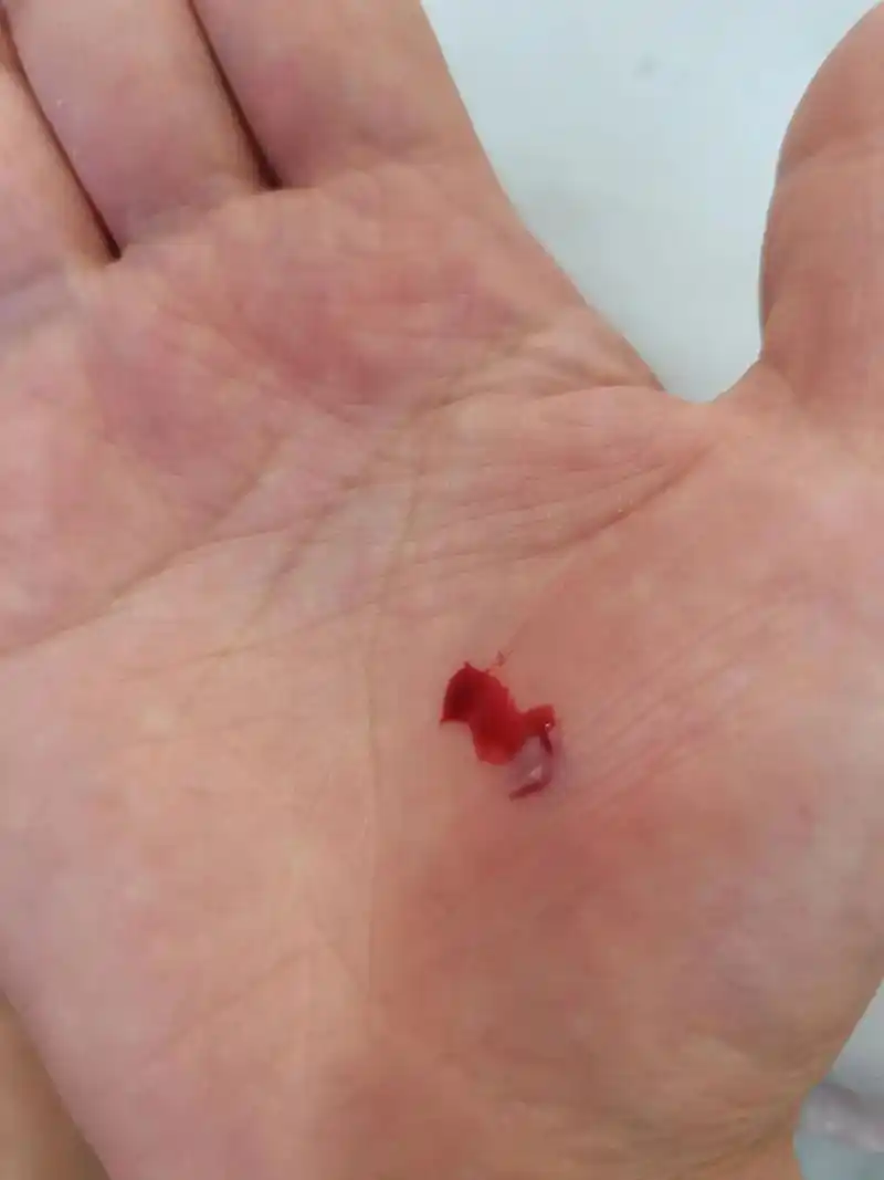 有一种疼叫做看着都疼 #我的手 #流血 #遍体鳞伤 - 抖音